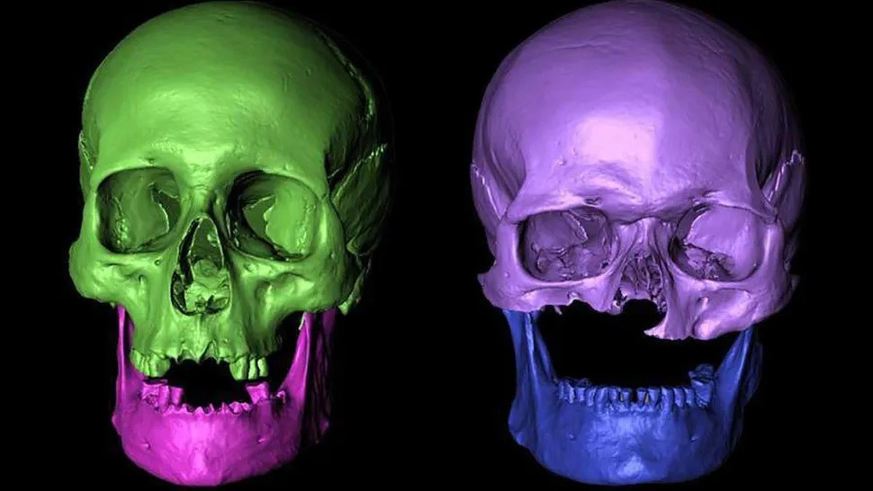 Sau một loạt kiểm tra, các chuyên gia giải mã được một số bí mật. Trong đó, họ xác nhận 6 người được chôn cất trong khoảng thời gian từ cuối thế kỷ 13 tới đầu thế kỷ 15. Hai người đàn ông có thể là anh em họ hoặc bác cháu. Ảnh: Adrian Evans/University of Bradford.