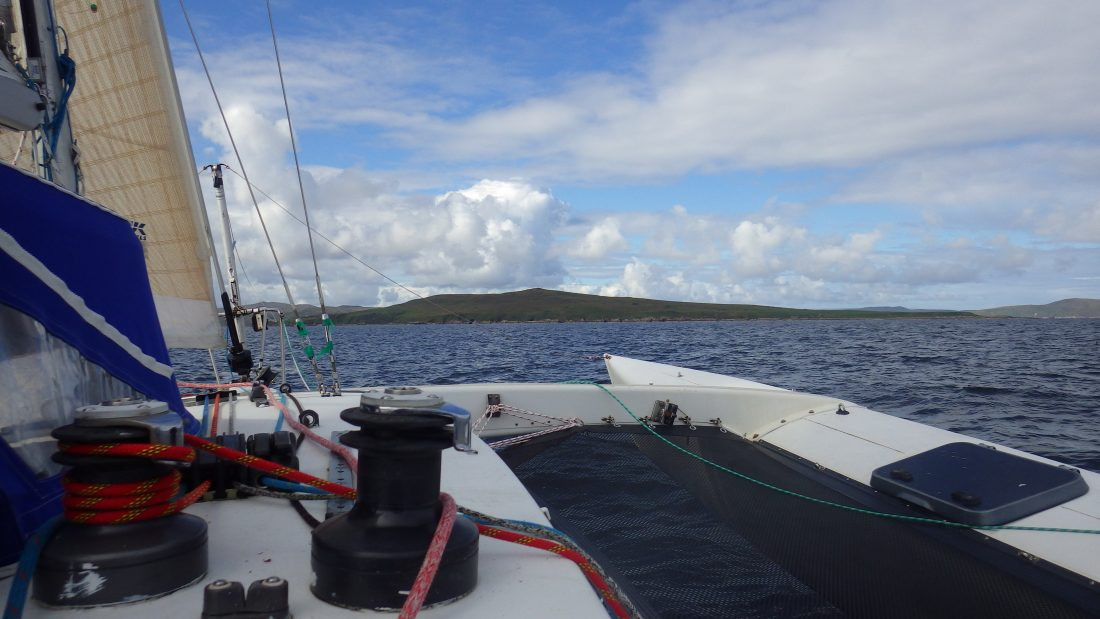 Khi hít phải, ăn hoặc chạm vào mầm bệnh than, nạn nhân sẽ nhanh chóng bị ốm với các triệu chứng: sốt cao, ớn lạnh, ho, khó thở, buồn nôn, nôn mửa, đổ mồ hôi và cực kỳ mệt mỏi. Căn bệnh nguy hiểm này có thể dễ dàng gây tử vong nếu không được điều trị thích hợp. Ảnh: Scotislands.