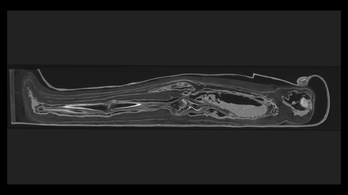 Giới chuyên gia cũng phát hiện xác ướp của quý bà Chenet-aa có đặt đôi mắt nhân tạo ở hốc mắt để giúp bà có thể nhìn được ở thế giới bên kia. Ảnh: The Field Museum.