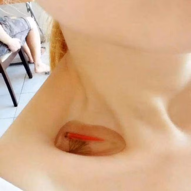 Đựng cá trong các hốc xương đòn là xu hướng mà các cô gái chứng tỏ mình gầy như thế nào.