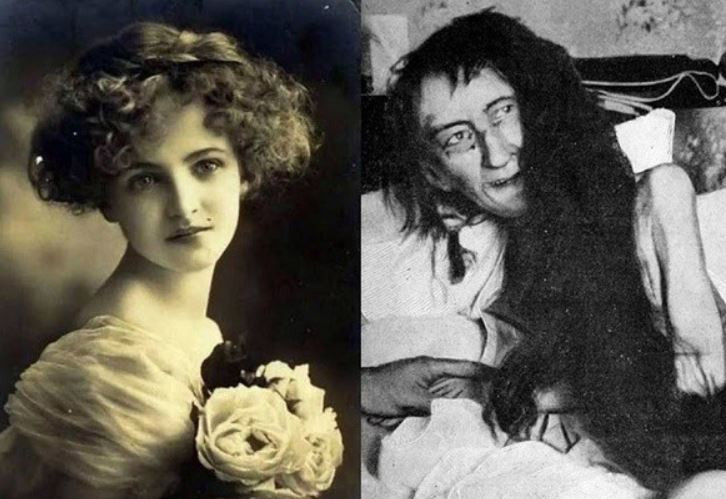 Nguyên nhân là họ cho rằng người mà con gái muốn cưới không có kinh tế vững chắc. Người này không thể cho Blanche cuộc sống của một tiểu thư như hiện tại.