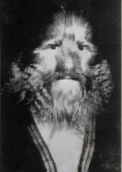 Đến năm 1901, Sedlmayer đưa Bibrowski đến Mỹ sinh sống và làm việc trong gánh xiếc Barnum &amp; Bailey. Kể từ đó, người đàn ông có gương mặt sư tử theo rạp xiếc đi nhiều nơi biểu diễn.