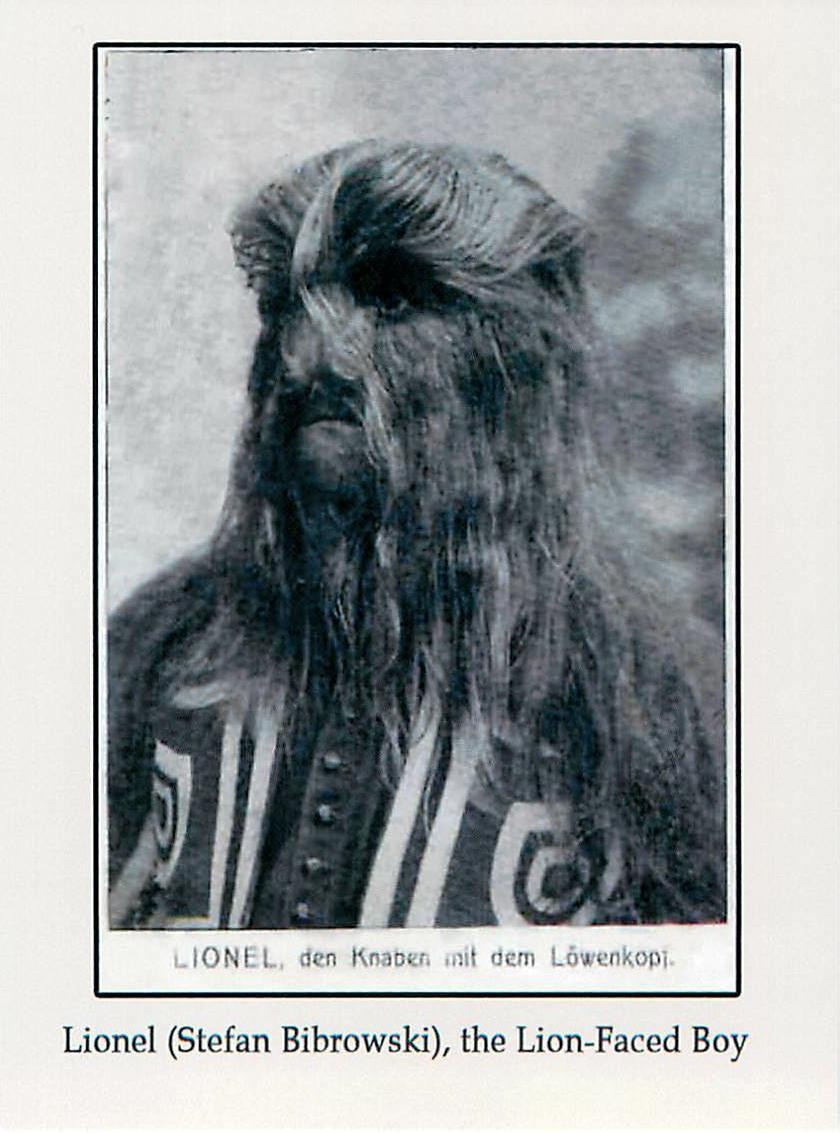 Trái với vẻ ngoài xấu xí như một quái thú, Bibrowski là một người hiền lành, tốt bụng với ước mơ trở thành nha sĩ.