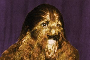 Về sau, giới khoa học và y tế xác định Bibrowski mắc chứng bệnh hiếm gặp gọi là hội chứng Hypertrichosis (bệnh người sói hay bệnh ma sói). Người mắc hội chứng này sẽ mọc lông và tóc ở khắp nơi trên cơ thể, gây ngứa ngáy và đau rát. Mời độc giả xem video: Dị nhân nửa người nửa cáo ở Pakistan. Nguồn: VTC14.