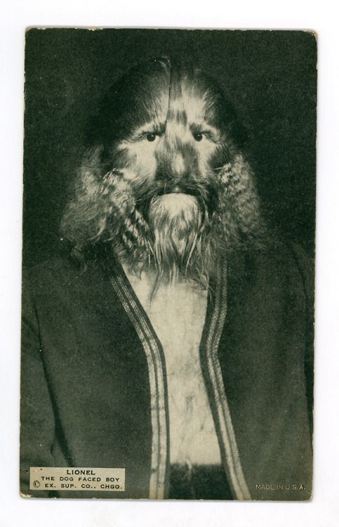 Một số người cho hay Bibrowski là người thông minh, thành thạo 5 thứ tiếng nhưng không có vợ con. Vào năm 1932, Bibrowski qua đời trong sự cô đơn, không có người thân.