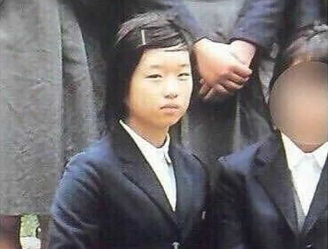 Trước đây, Go Youn Jung luôn tự ti với đôi mắt một mí, chiếc mũi tẹt và gò má cao của mình. Thời đi học, cô từng nhiều lần bị bạn bè bắt nạt bởi ngoại hình xấu xí và không mấy nổi bật