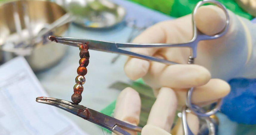 Be 2 tuoi dau bung du doi, di kham phat hien chuyen kinh di