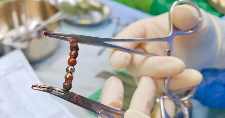 Be 2 tuoi dau bung du doi, di kham phat hien chuyen kinh di