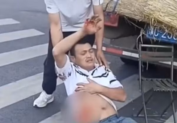 Mua phai dua hau nhat, nguoi dan ong lam dieu kinh hai