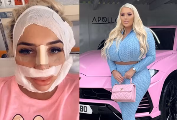 Co gai phau thuat nang nguc lien tuc, bac si cung am anh