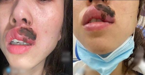 Dang ngu thay moi dau nhoi, tinh day phat hien chuyen kinh di