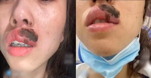 Dang ngu thay moi dau nhoi, tinh day phat hien chuyen kinh di