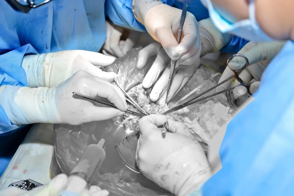 Một phần gan trái của người hiến được ghép cho người bệnh tại Bệnh viện Đại học Y Dược TP.HCM. Người nhận tạng hiến là bệnh nhi 3 tuổi bị xơ gan giai đoạn cuối, đang chờ được ghép gan.