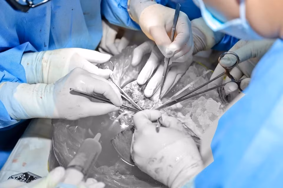 Một phần gan trái của người hiến được ghép cho người bệnh tại Bệnh viện Đại học Y Dược TP.HCM. Người nhận tạng hiến là bệnh nhi 3 tuổi bị xơ gan giai đoạn cuối, đang chờ được ghép gan.