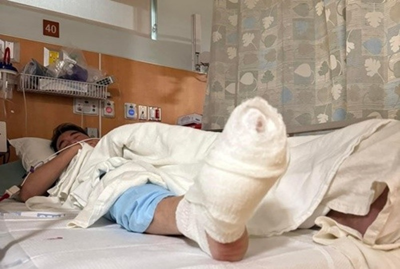 Vào tháng 2/2024, Đàm Vĩnh Hưng gặp tai nạn sân khấu ở Mỹ. “Được mọi người cổ vũ nên sung lại càng sung hơn, định leo lên chỗ cao để các khán giả ở xa cũng có thể thấy được Hưng. Không ngờ là khu vực không an toàn lắm, ngã oành xuống, vết thương khá sâu và phải vào bệnh viện khâu rất nhiều mũi”, nam ca sĩ cho biết.