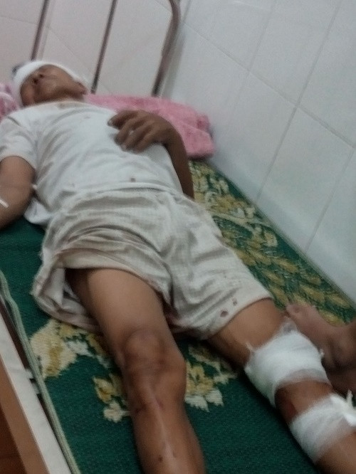 Con dau thue gan 50 con do xu nha chong