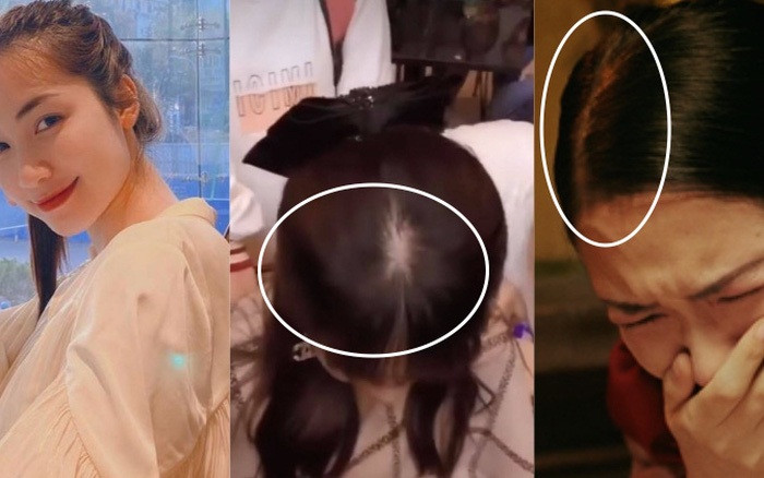 Ngoài hình ảnh tự chia sẻ, tình trạng tóc rụng nhiều, hói cả mảng của Hòa Minzy còn được người hâm mộ soi ra trong nhiều khung hình. Ngay cả khi chăm chút kỹ thì mỹ nhân Bắc Ninh vẫn để lộ phần da ở đỉnh đầu.