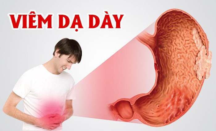 Các đối tượng âm hư hỏa vượng, viêm phổi, mắc chứng lao phổi, viêm loét dạ dày, viêm thận, đái tháo đường, trĩ, mọc nhiều mụn nhọt không thích hợp dùng gừng trong thời gian dài.