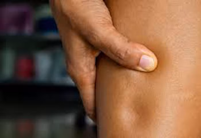 Trái lại, những người bị phù thũng ăn gừng không nên gọt vỏ mới tận dụng được vai trò lợi tiểu.