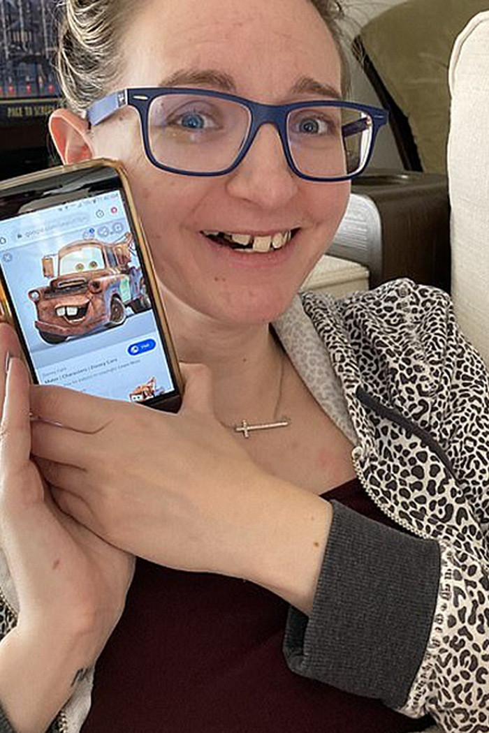 Trismus thậm chí khiến cô gái 28 tuổi không thể mở rộng khoang miệng dù chỉ 1cm. Điều này khiến Nicole vô cùng khổ sở trong việc ăn uống, giao tiếp. Để đưa thức ăn vào miệng, Nicole phải sử dụng dụng cụ hỗ trợ 4 -5 lần mỗi ngày. Cô cũng theo khóa trị liệu ngôn ngữ hai lần một tuần.