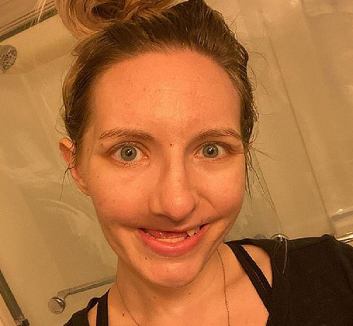 Tháng 12 năm 2019, kết quả chụp PET/CT cho thấy ung thư quay trở lại và xương hàm của Nicole đang “chết dần”. Nicole tiếp tục tiến hành phẫu thuật loại bỏ vòm miệng cứng, mềm và 7 chiếc răng khác – bao gồm cả răng cửa. Cô cũng thực hiện xạ trị thêm 30 ngày để tiêu diệt tế bào ung thư tái phát.