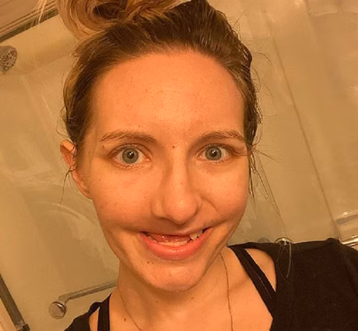 Tháng 12 năm 2019, kết quả chụp PET/CT cho thấy ung thư quay trở lại và xương hàm của Nicole đang “chết dần”. Nicole tiếp tục tiến hành phẫu thuật loại bỏ vòm miệng cứng, mềm và 7 chiếc răng khác – bao gồm cả răng cửa. Cô cũng thực hiện xạ trị thêm 30 ngày để tiêu diệt tế bào ung thư tái phát.