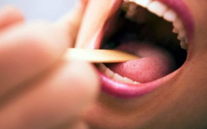 Có thể nói, lưỡi là tấm gương phản chiếu sức khỏe. Nó liên tục phát ra tín hiệu nhắc nhở về những bệnh hiểm có thể xảy ra. Để có kết quả chính xác, bạn nên kiểm tra lưỡi vào buổi sáng trước khi đánh răng. Sử dụng ánh sáng tự nhiên để soi, tránh làm sai lệch kết quả. Đặc biệt một điều quan trọng, bạn phải bảo đảm răng lưỡi mình sạch, không bị dính thức ăn hay màu sắc của thức ăn. Ảnh: Internet.