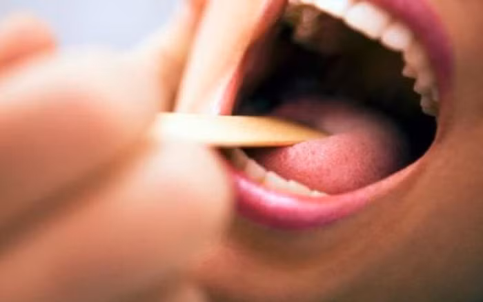 Có thể nói, lưỡi là tấm gương phản chiếu sức khỏe. Nó liên tục phát ra tín hiệu nhắc nhở về những bệnh hiểm có thể xảy ra. Để có kết quả chính xác, bạn nên kiểm tra lưỡi vào buổi sáng trước khi đánh răng. Sử dụng ánh sáng tự nhiên để soi, tránh làm sai lệch kết quả. Đặc biệt một điều quan trọng, bạn phải bảo đảm răng lưỡi mình sạch, không bị dính thức ăn hay màu sắc của thức ăn. Ảnh: Internet.