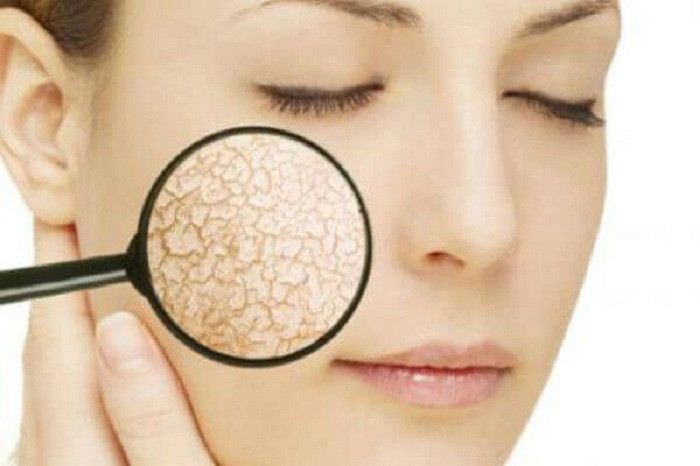 Da khô. Thận khỏe mạnh thực hiện các công việc là loại bỏ chất thải và một số chất dư thừa từ máu, giúp tạo ra các tế bào hồng cầu và duy trì lượng khoáng chất thích hợp trong cơ thể. Da ngứa và khô báo hiệu thận hoạt động chưa thực sự tốt để duy trì sự cân bằng cơ thể.