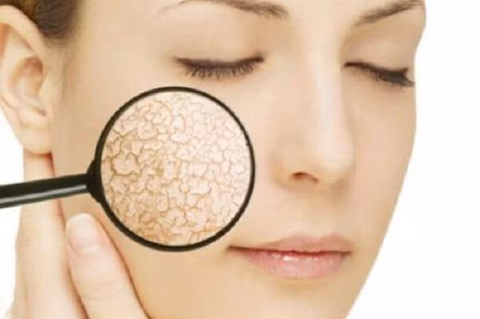 Da khô. Thận khỏe mạnh thực hiện các công việc là loại bỏ chất thải và một số chất dư thừa từ máu, giúp tạo ra các tế bào hồng cầu và duy trì lượng khoáng chất thích hợp trong cơ thể. Da ngứa và khô báo hiệu thận hoạt động chưa thực sự tốt để duy trì sự cân bằng cơ thể.