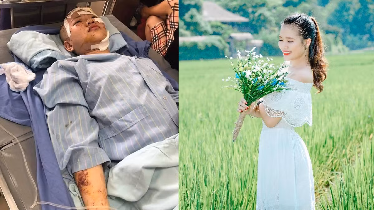 Xot xa 2 chi em sap thi THPT quoc gia 2019 bi tai nan: Em chet, chi chan thuong so nao