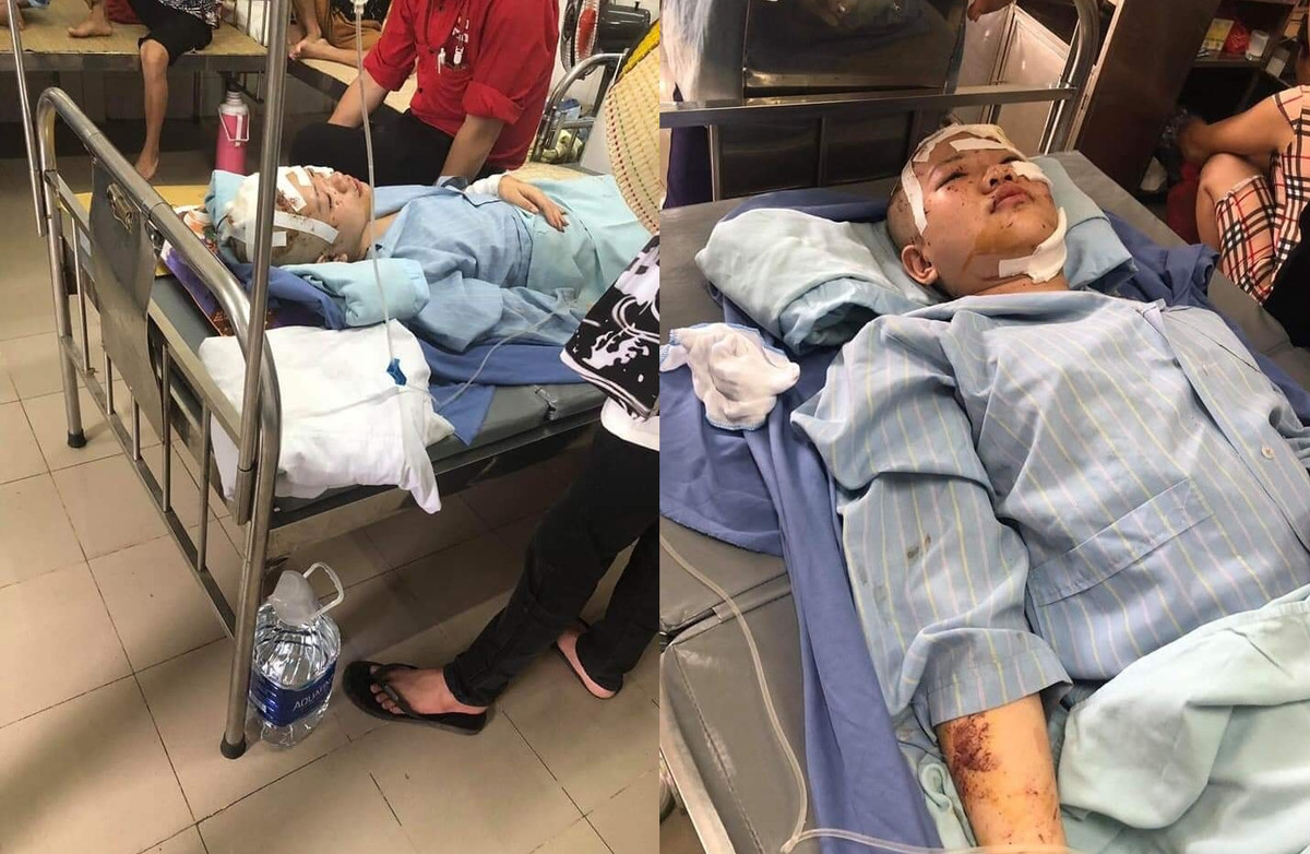 Chị Lường Thị Thiêm (SN 1987, cô ruột nạn nhân) cho biết: em Thu nhập viện trong tình trạng chấn thương sọ não, vỡ xương gò má và đang trong trạng thái hoảng loạn. Thu chưa tỉnh để nhận biết được mọi người xung quanh.