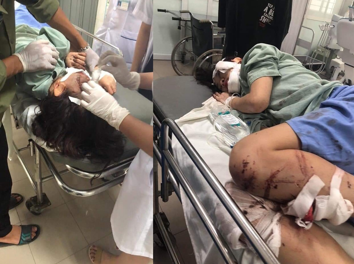 Theo ghi nhận của PV Kiến Thức, em Lường Thị Thu vẫn đang trong tình trạng hôn mê, vẫn phải chờ quyết định của bác sĩ xem có phẫu thuật hay không. Trong trường hợp phải phẫu thuật, gia đình nữ sinh chưa biết phải xoay sở như thế nào.