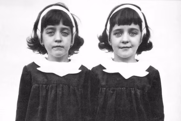 Cặp song sinh nhà Pollock là hai cô gái người Anh thường được đề cập đến như bằng chứng kỳ lạ của hiện tượng luân hồi. Cha mẹ họ, ông bà John và Florence Pollock, sống ở thị trấn Hexham, Anh.