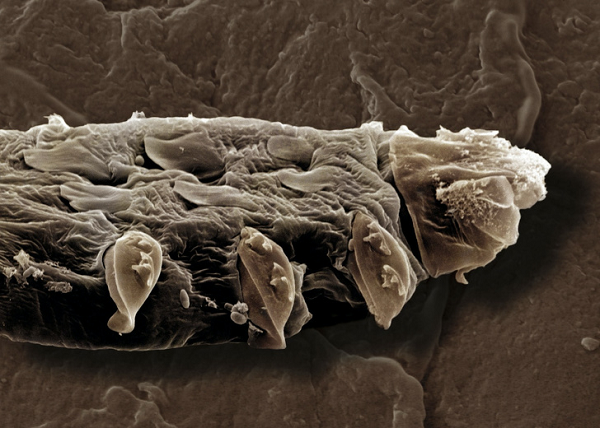 1/3 trẻ em, 1/2 người lớn và 2/3 người cao tuổi có ký sinh trùng Demodex trên mặt. Hầu hết thời gian, nó sống bên trong hoặc gần các nang lông của lông mày, lông mi và mũi.