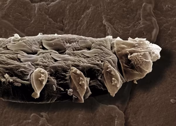 1/3 trẻ em, 1/2 người lớn và 2/3 người cao tuổi có ký sinh trùng Demodex trên mặt. Hầu hết thời gian, nó sống bên trong hoặc gần các nang lông của lông mày, lông mi và mũi.