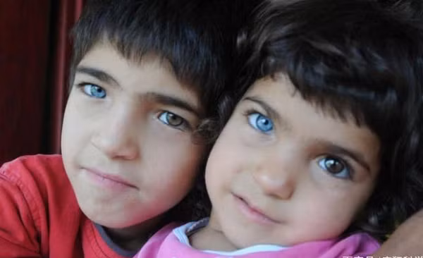 Do hiện tượng “loạn sắc tố mống mắt” nên một số người sẽ may mắn sở hữu cặp mắt đặc biệt này. Trên thế giới, một số người nổi tiếng như Mila Kunis, Kate Bosworth cũng sở hữu cặp mắt 2 màu.