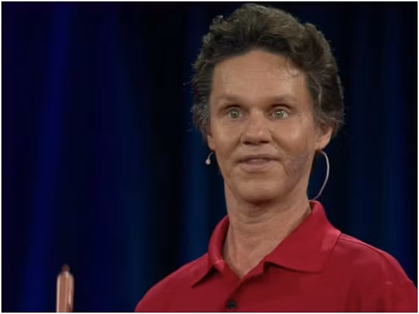 Phần lớn thế giới đã biết về khả năng tạo ra tiếng dội của con người nhờ Daniel Kish. Ông là một người mù có thể tạo ra những âm thanh mà ông sử dụng như một máy định vị để giúp ông đi xe đạp hay đi qua những vùng hoang dã. Các nhà nghiên cứu đã nhận ra rằng, đây không phải là điều độc nhất vô nhị của Kish hoặc một vài người.