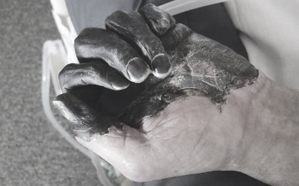 Năm 1400 là thời kỳ khủng khiếp của dịch hạch, lan tràn nhiều nơi trên thế giới, đặc biệt là châu Âu - nơi ước tính có 2/3 dân số đã bị quét sạch.