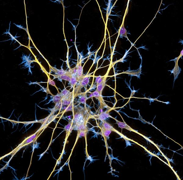 Tế bào thần kinh từ tế bào gốc.