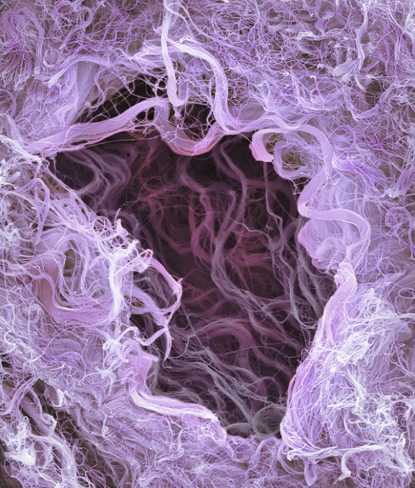 Các bó collagen ở dây rốn.