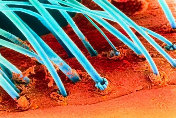 Cận cảnh lông mi và vùng da xung quanh của nó.