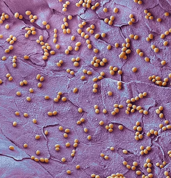 Bào tử của nấm gây ra bệnh nấm da chân.