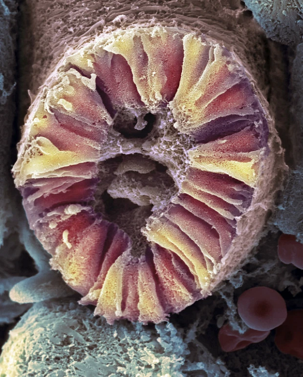 Nephron, đơn vị cơ bản cấu tạo nên thận ở người.