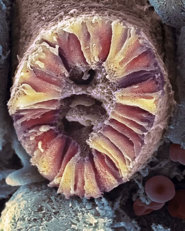 Nephron, đơn vị cơ bản cấu tạo nên thận ở người.