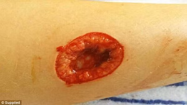 Được biết, sinh vật nhỏ nhưng ghê gớm này có tên là cá mâp cắt bánh quy (Tên khoa học: Isistius brasiliensis) - một loài cá mập nhỏ trong họ Dalatiidae, thường sống ở vùng biển ấm của các đại dương trên toàn thế giới, đặc biệt là gần các đảo.