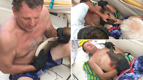 Khi đang lặn xuống biển để bắt cá mú ở bờ biển Boca Raton, Florida, ông Ervin McCarty vô tình bị một sinh vật kỳ lạ bám chặt vào bụng và cắn khiến ông lập tức phải quay lại thuyền.