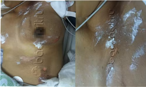 Cúu song mọt phu nu dang mang thai bị sét dánh