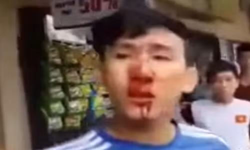 GD Cong an chỉ dạo làm rõ vụ dan “tó” CSCD dánh nguòi