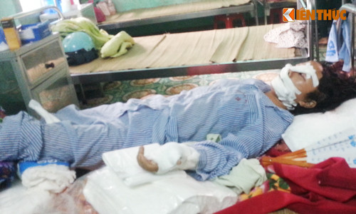 Chòng cát gan tay, gan chan vọ: Nạn nhan dã tỉnh lại